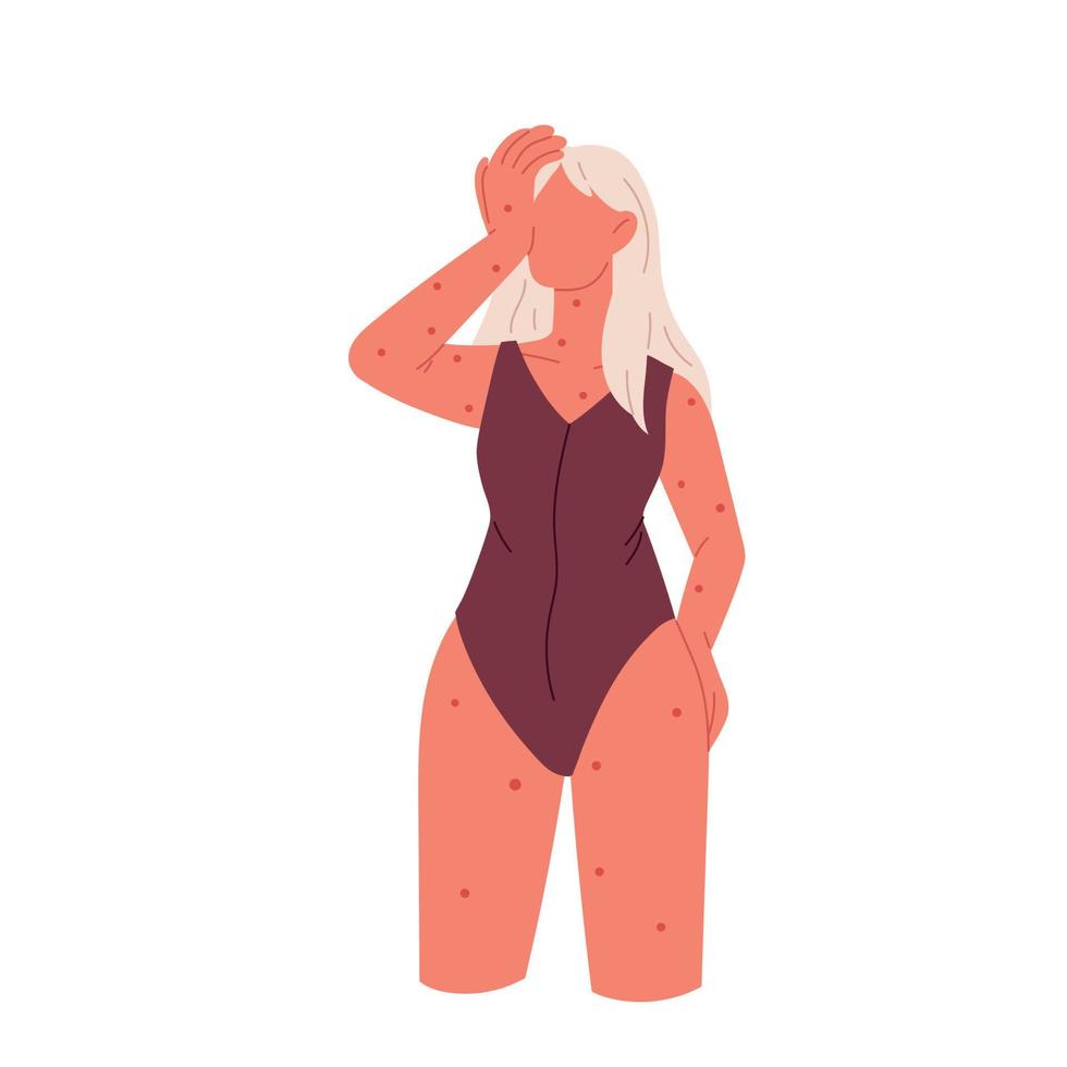 Rash on the skin. Autoimmune disease, chickenpox, atopic dermatitis. A woman has a rash. Flat vector illustration