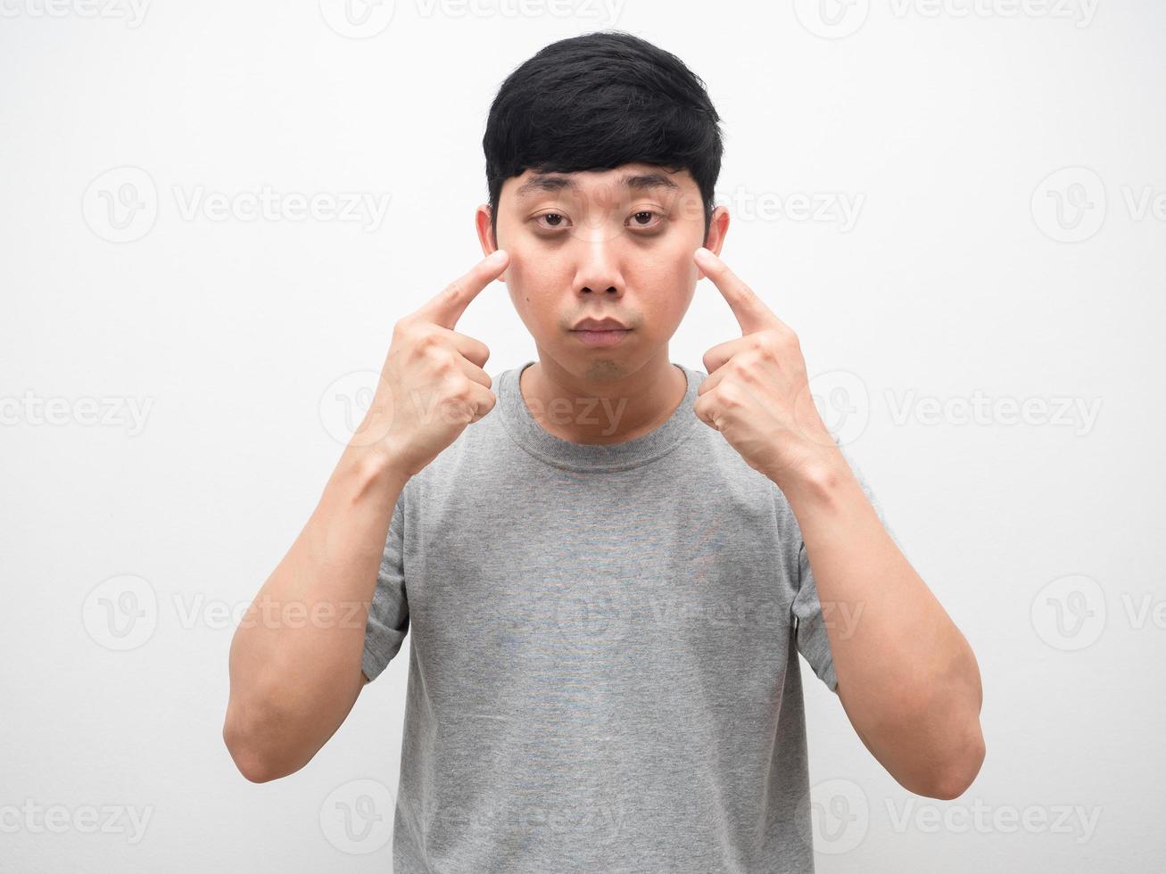 Asian man sleepless point finger at dark circle under his eyes photo