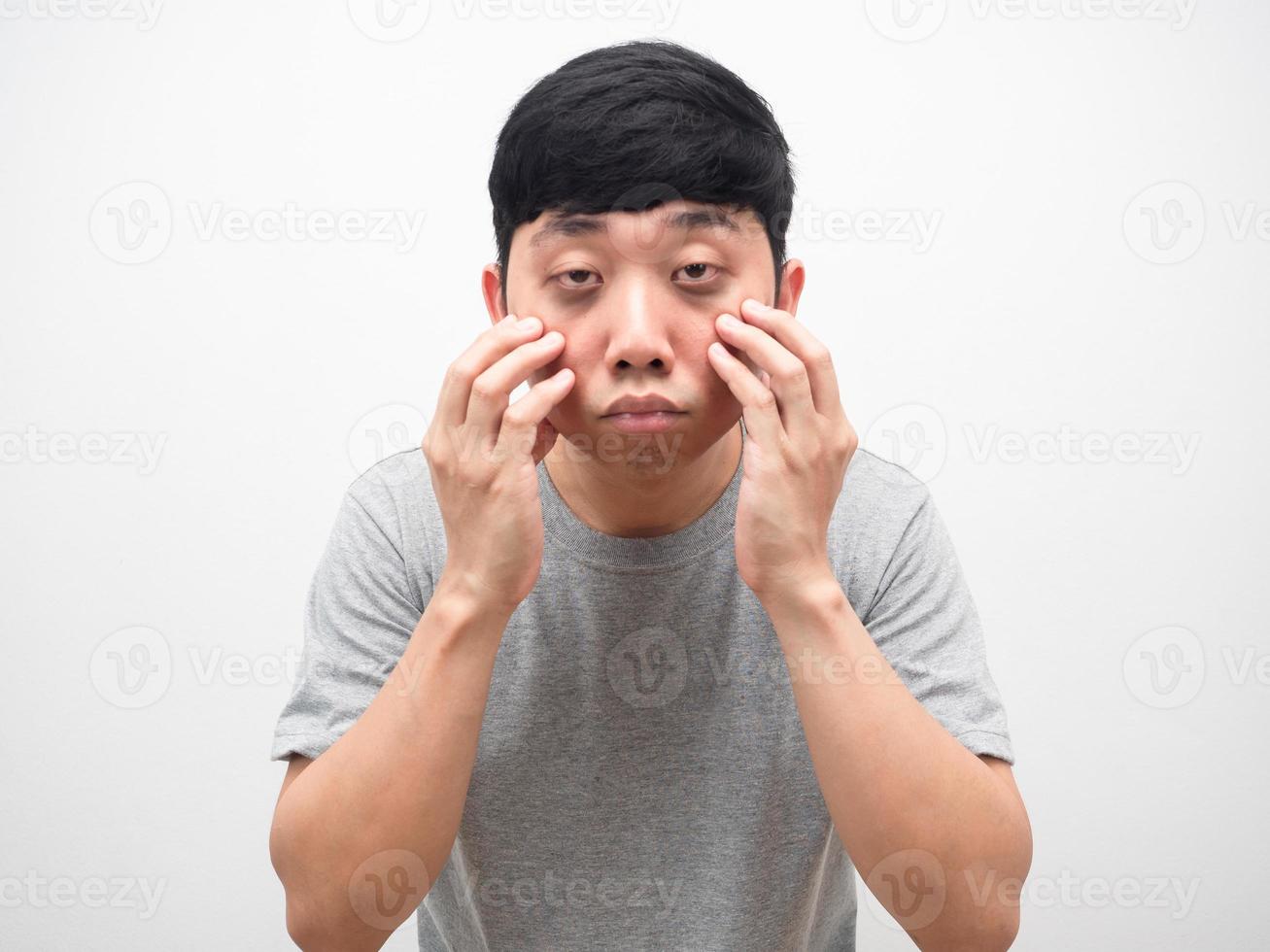 Man sleepless black circle under the eyes gesture open eyes photo