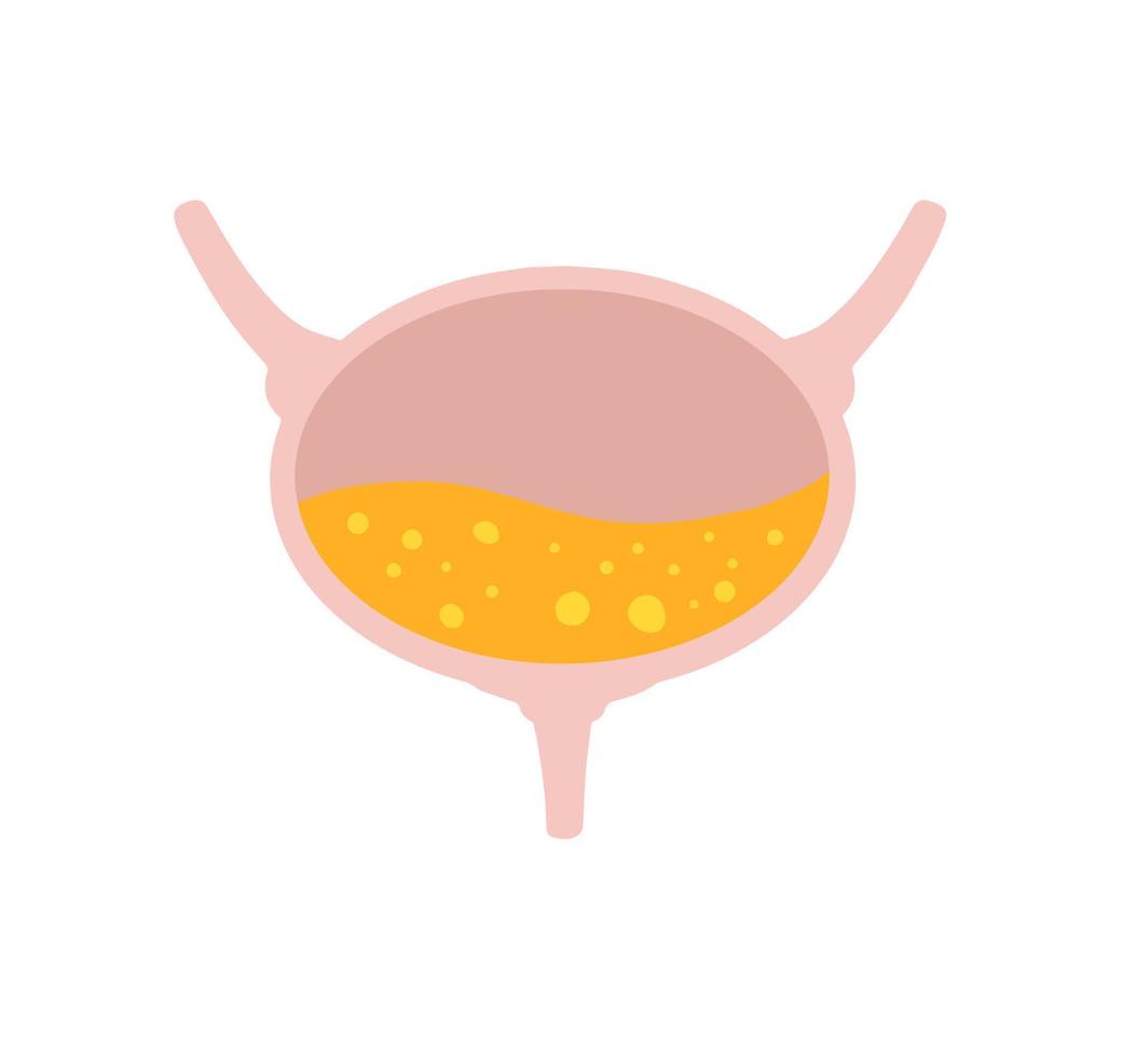 Bladder with urine. Internal organ of a person. Medical illustration. vector