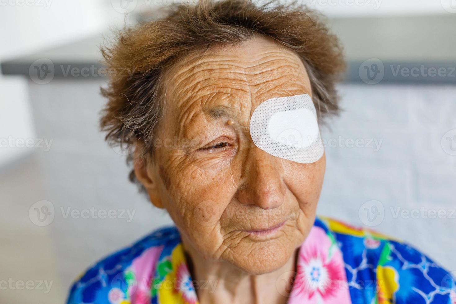 elderly woman with one eye surgery photo