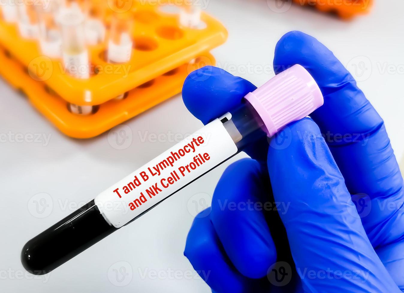 Blood sample for T lymphocyte, B lymphocyte and Natural killer cell profile test. photo