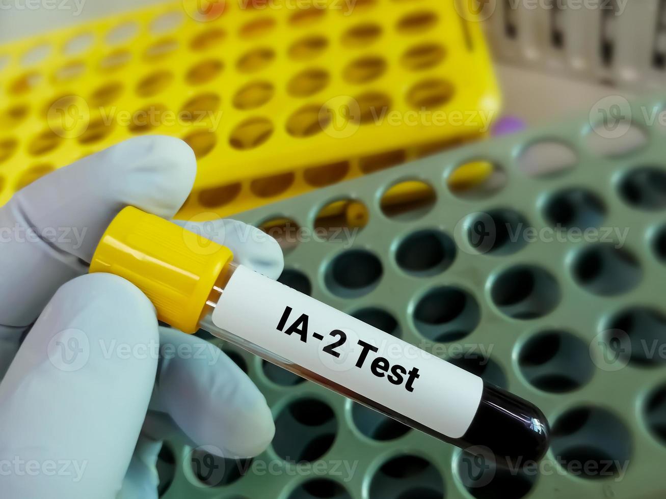 Blood sample for Islet Antigen-2 or IA 2 test, Pancreatic islet antibody and an important serological marker of predisposition to type 1 diabetes. photo