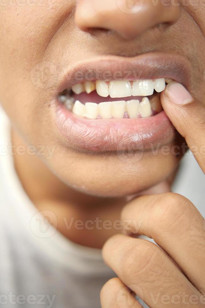 teenage boy with sensitive teeth photo