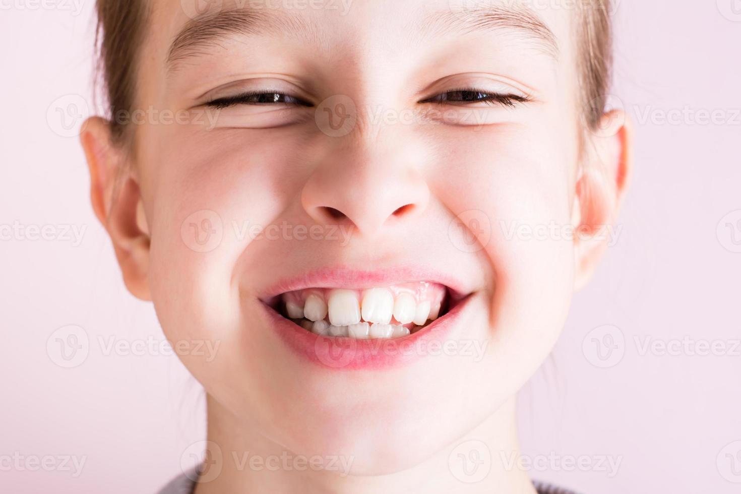 Portrait of a girl with crooked teeth on a pink background. Dentistry and orthodontics photo
