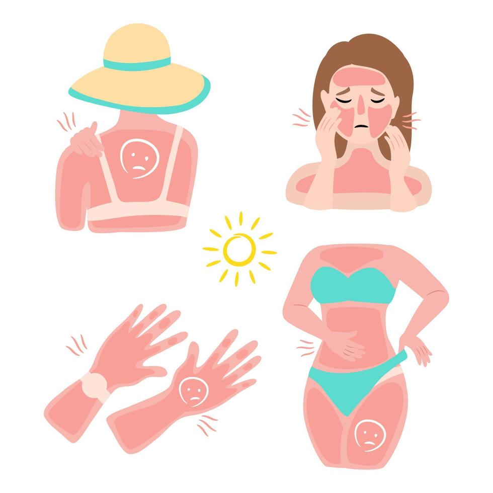 mujer con quemaduras solares en la cara y la piel del cuerpo. la radiación ultravioleta daña la piel en los calurosos días de verano. ilustración vectorial vector