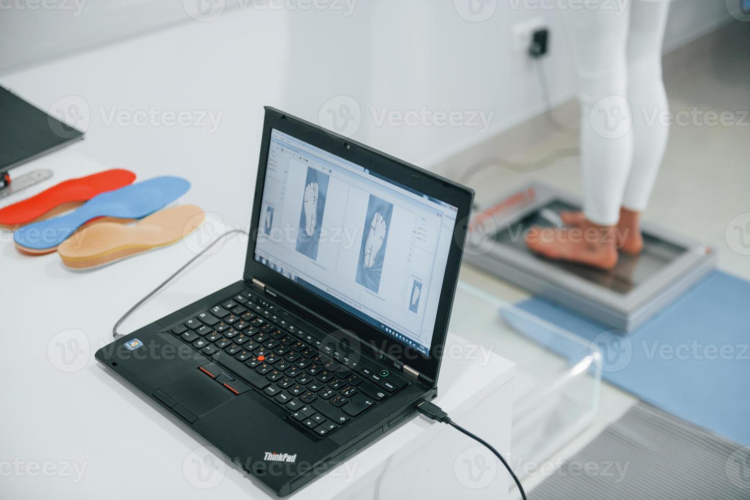 Computer scan. Foot treatment for Podiatry. Conception of healthcare photo