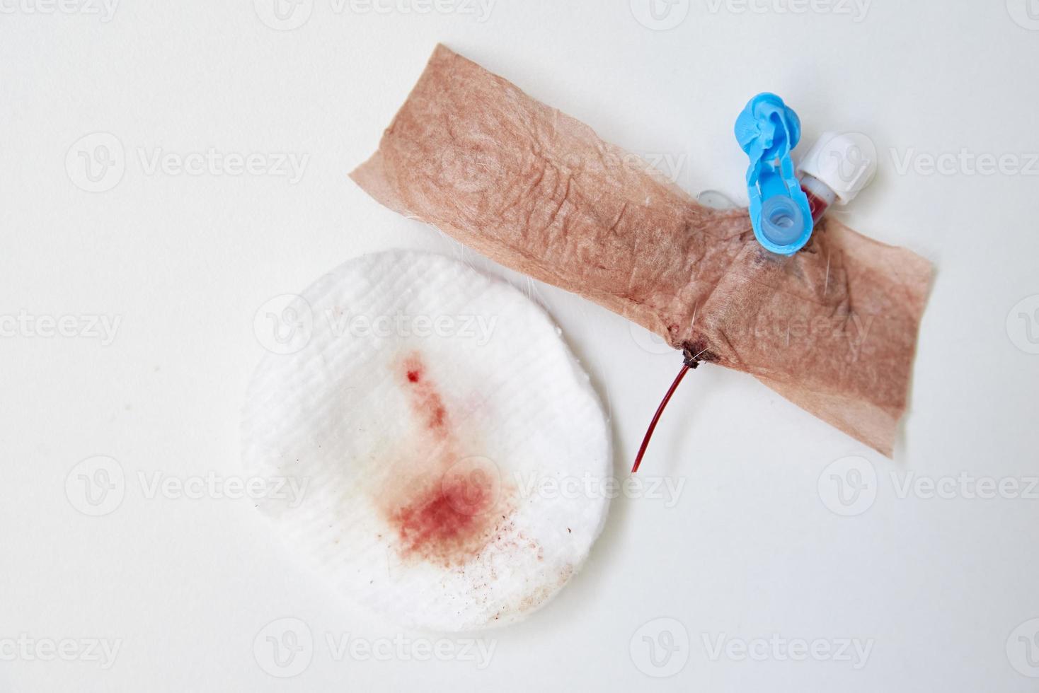 Used catheter on white background photo