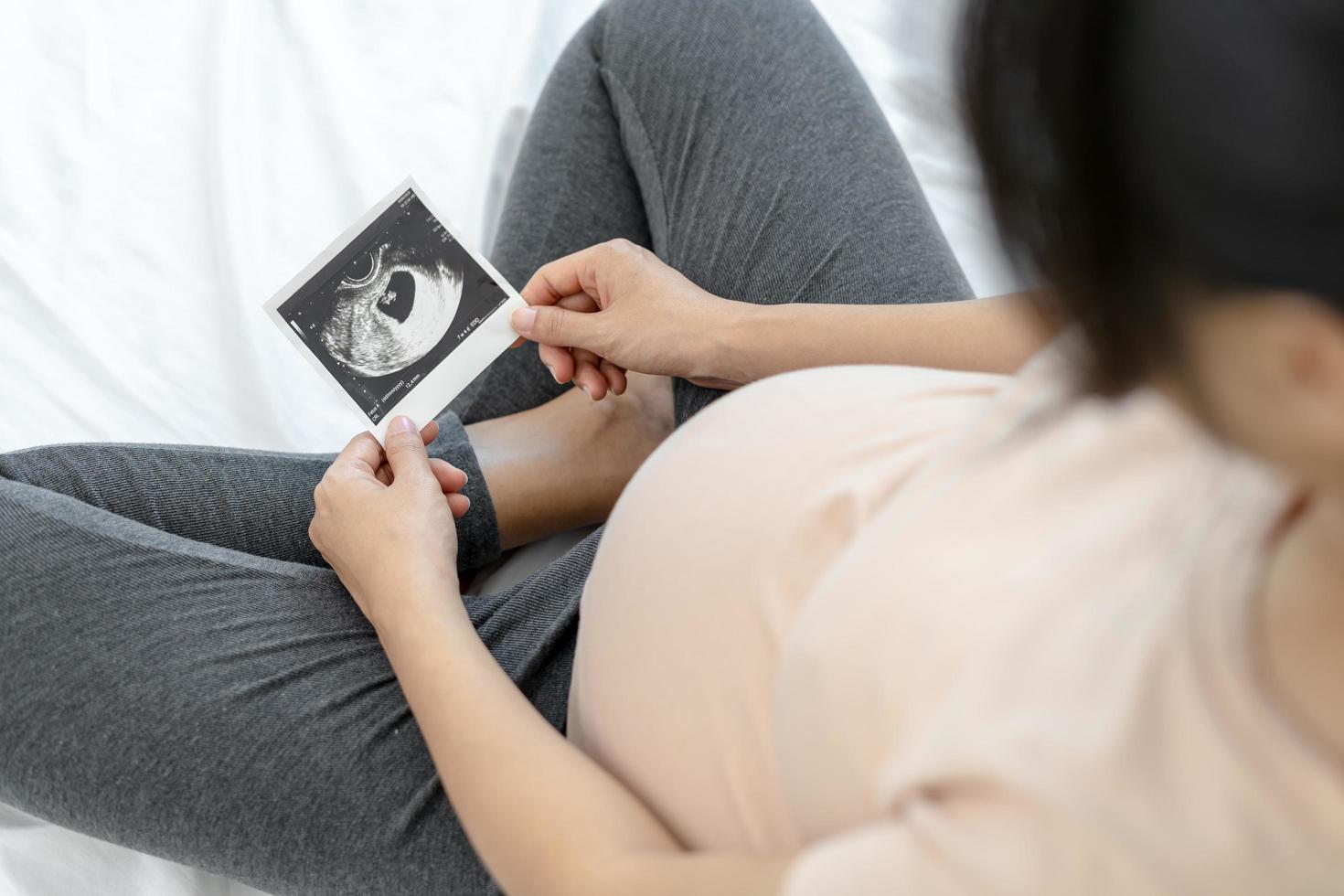 mujer embarazada estaba viendo la ecografía de su hija en su útero. Las imágenes de ultrasonido pueden ayudar a mostrar al bebé sobre el desarrollo. cuidado fetal, foto