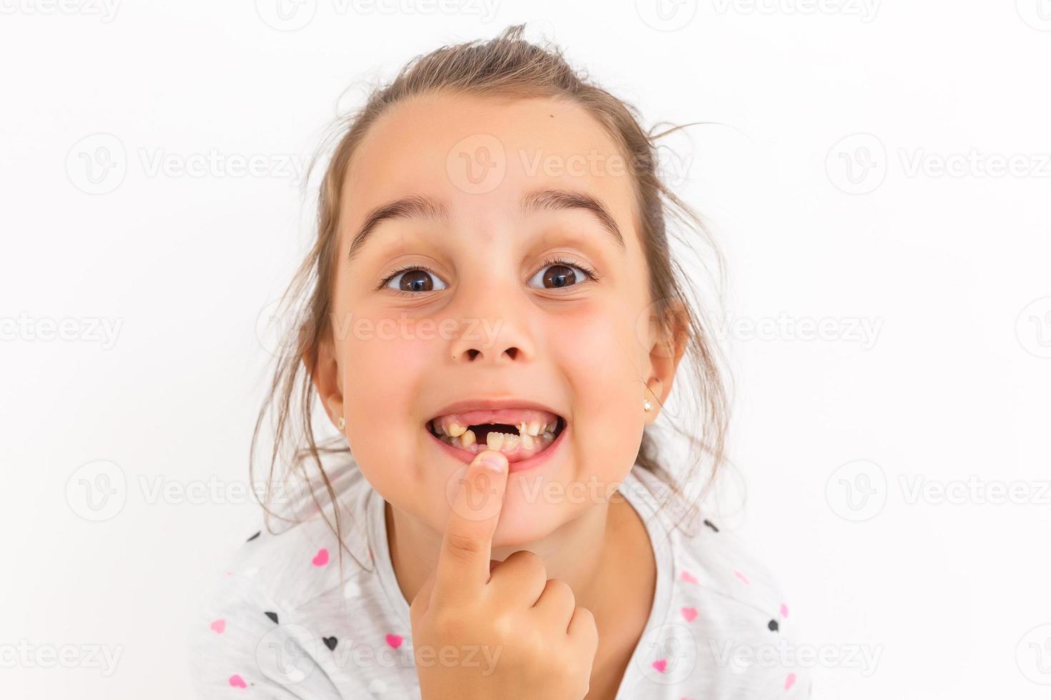 falta el primer diente de la niña en un fondo blanco foto