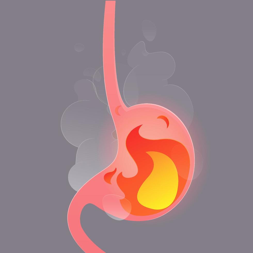 Illustration from acid reflux or heartburn vector