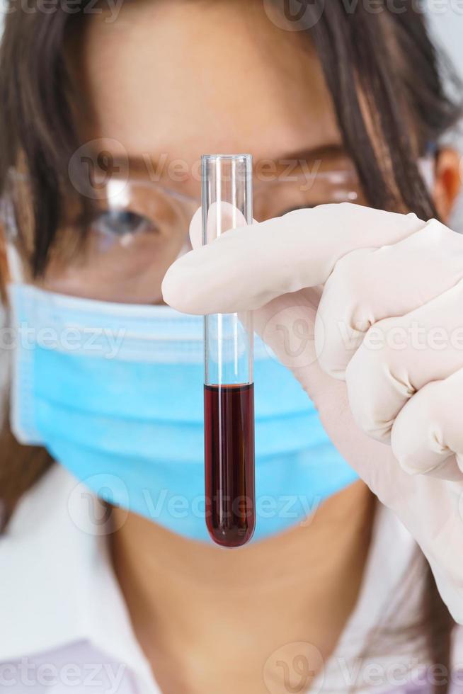 Scientist analyzing holding blood sample in test tube photo