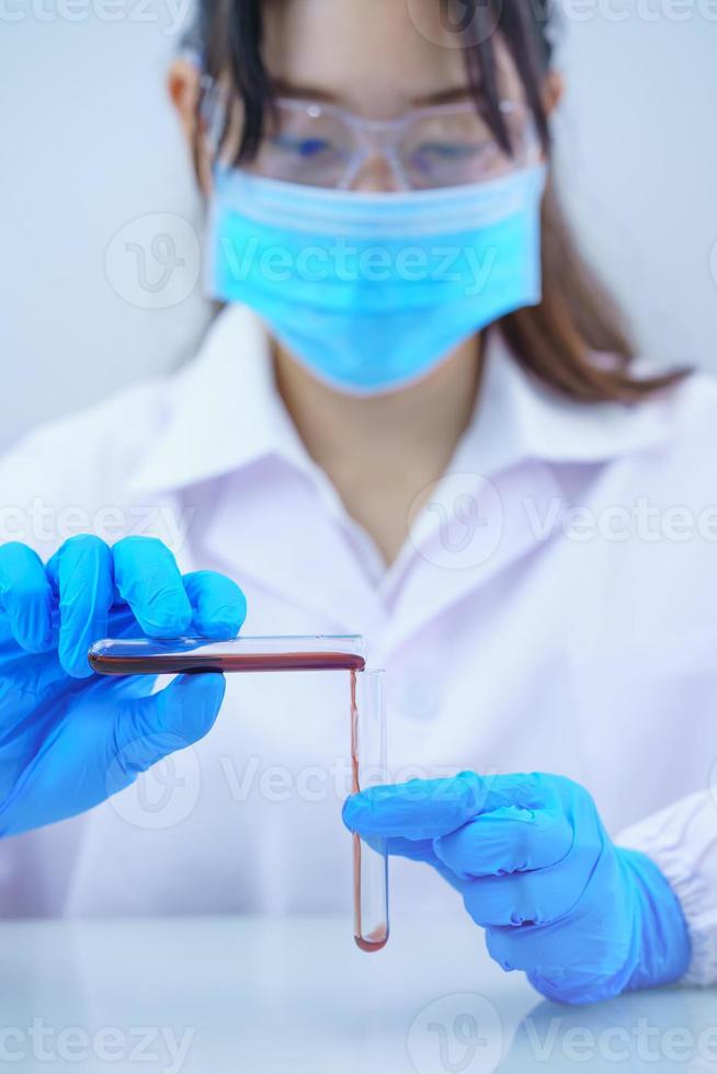 Scientist analyzing a blood sample in test tube photo