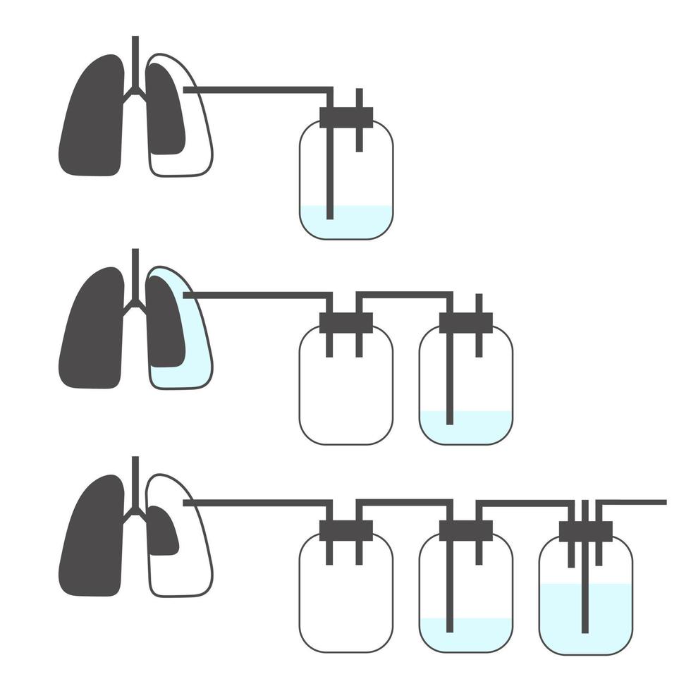 Infographic of Intercostal Drainage System on White Background vector