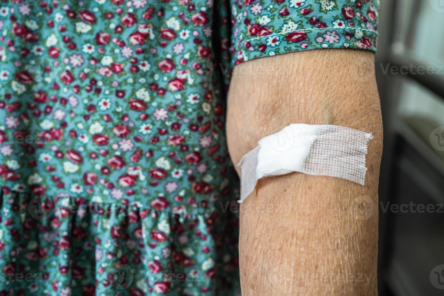 Asian senior or elderly old lady woman patient show cotton wool stop bleeding, after blood drawing testing for annually physical health check up to check cholesterol, blood pressure, and sugar level. photo