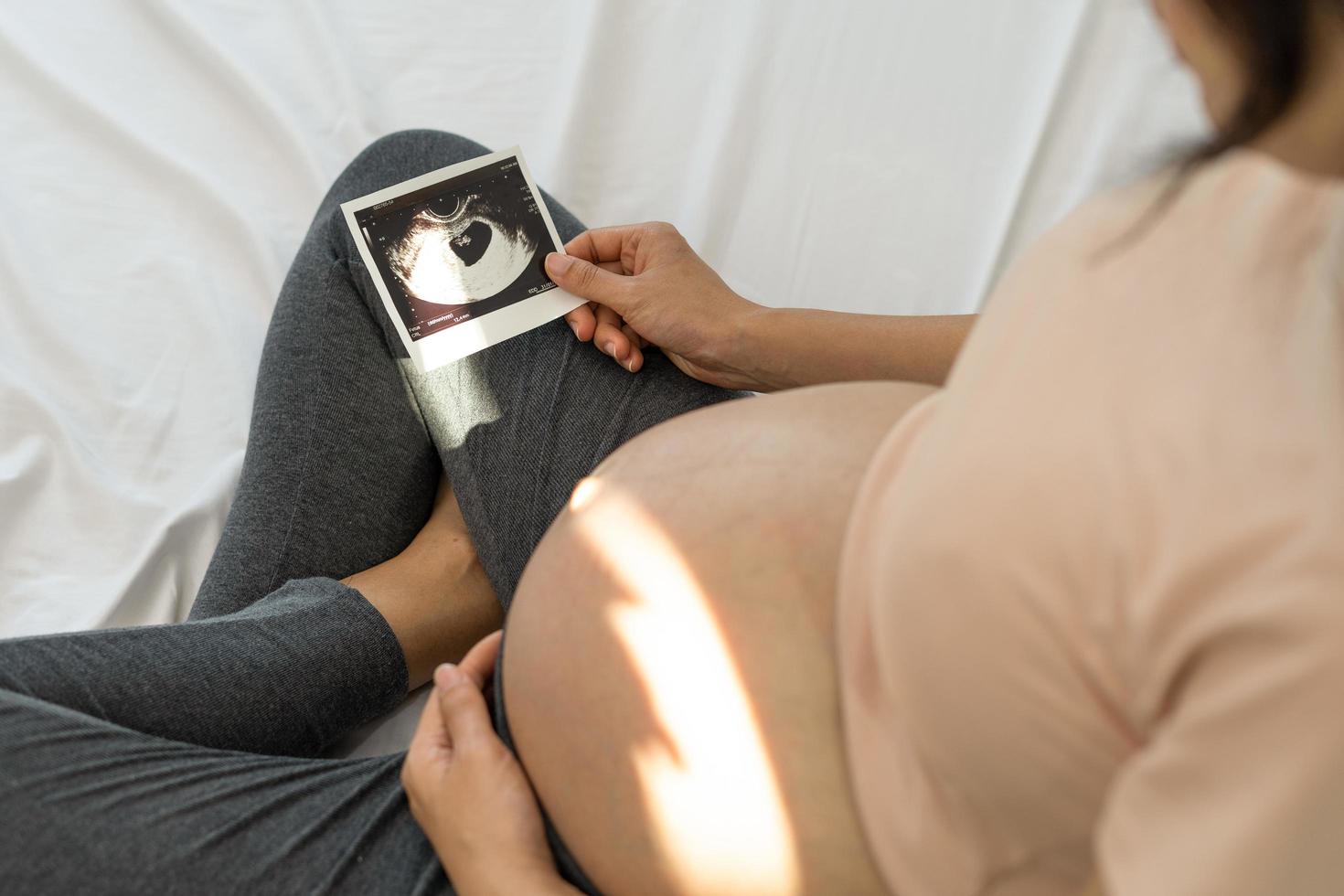 una mujer embarazada está mirando una foto de ultrasonido del feto. la madre toca suavemente al bebé en el estómago. las mujeres están embarazadas durante 2-3 días o durante el primer trimestre.