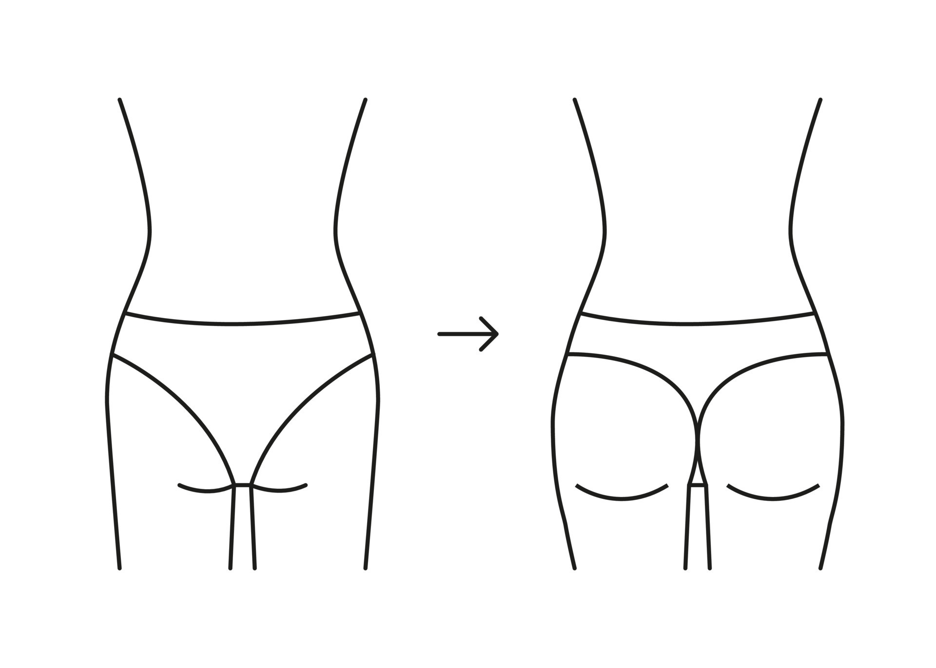 Types of butt woman, shape buttock back, line icon. Augmentation