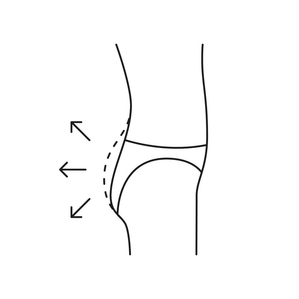 aumento de glúteos de mujer, lado de glúteos de forma, icono de línea. Aumento plano, remodelación de glúteos. procedimientos medicos esteticos, clinica de cirugia plastica. ilustración de contorno vectorial vector