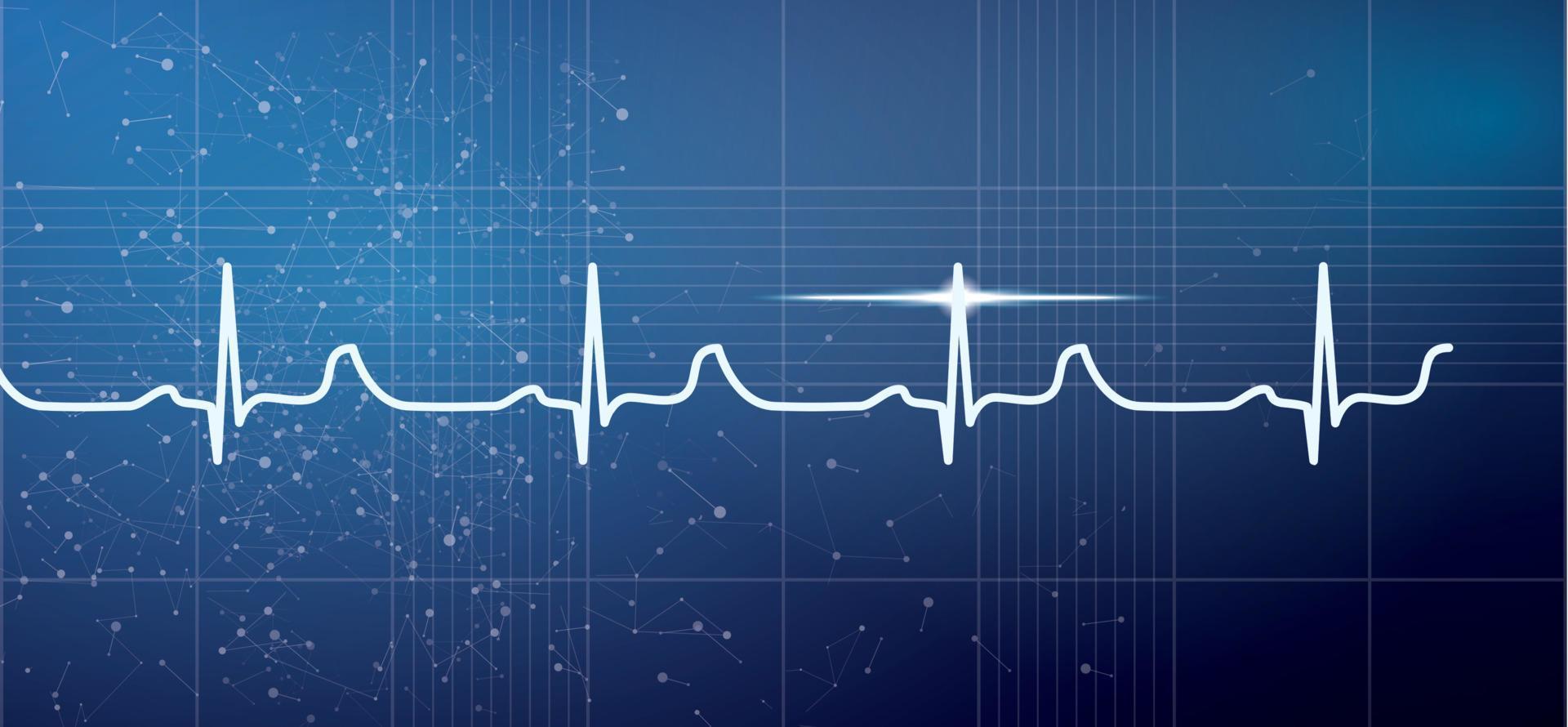 White Heart Beat Pulse Electrocardiogram Rhythm on Blue Background. vector