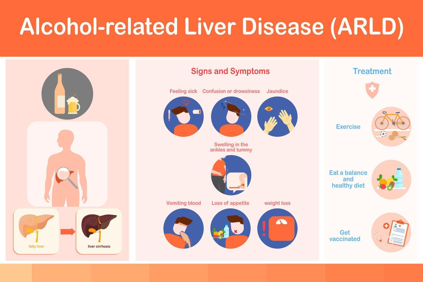 Vector illustration.infographic Signs and Symptoms of Alcoholic Fatty Liver Disease and treatment.flat design.