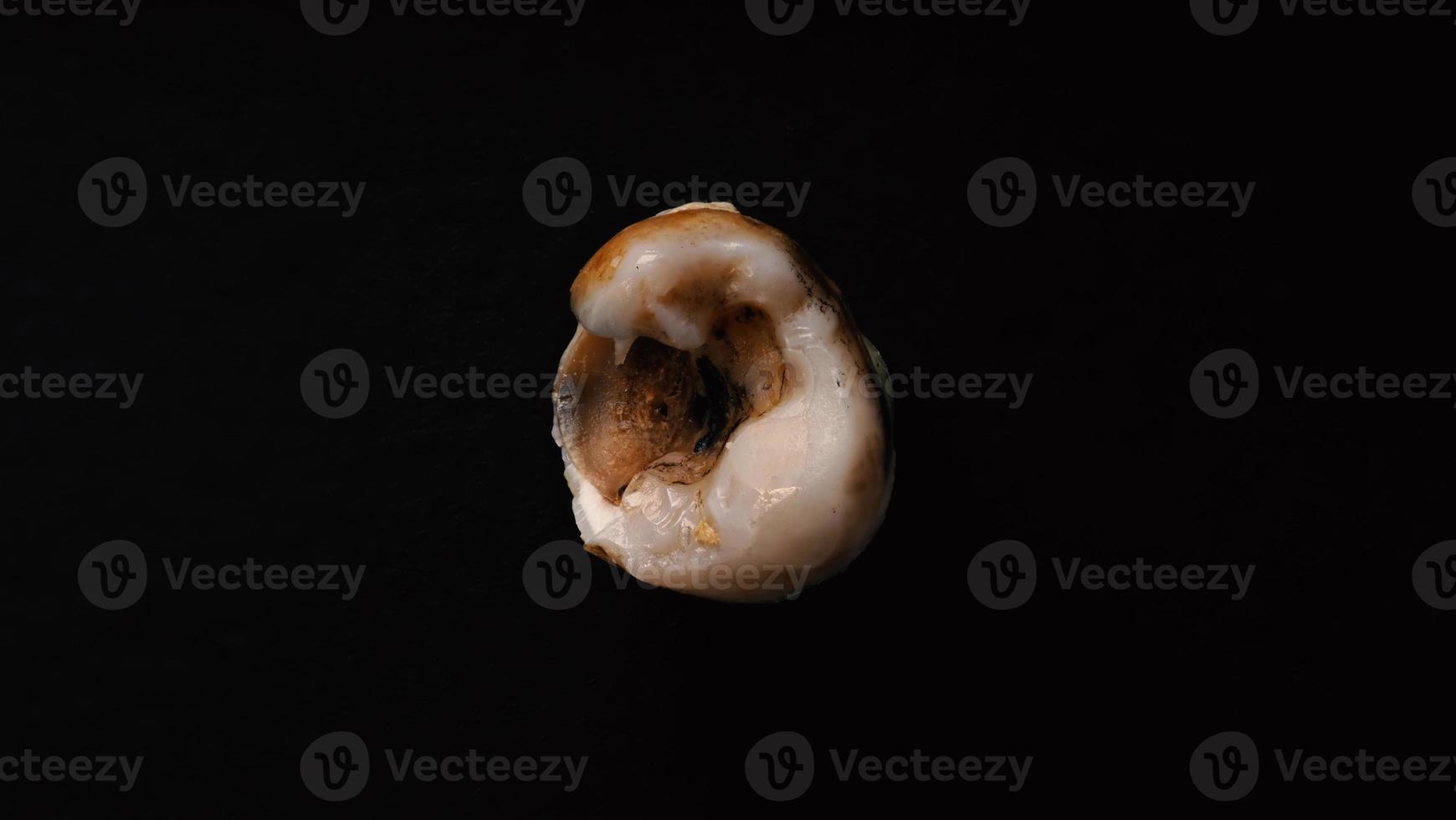 Macro shot of a decayed teeth till root after extraction of dentist. photo