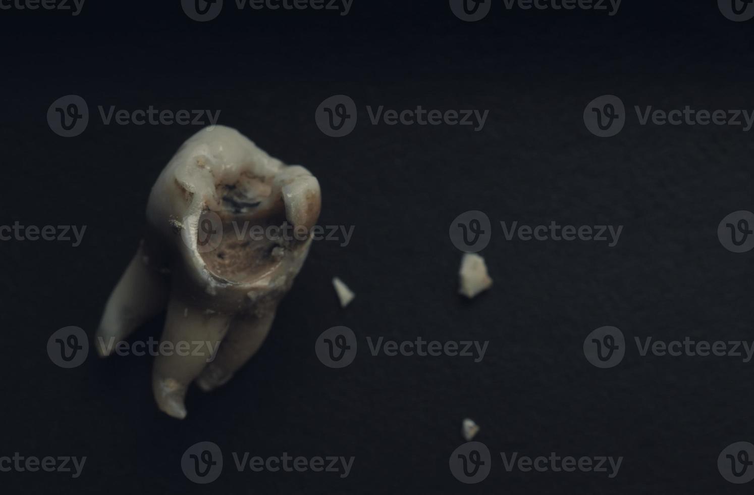 Macro shot of a decayed teeth till root after extraction of dentist. photo