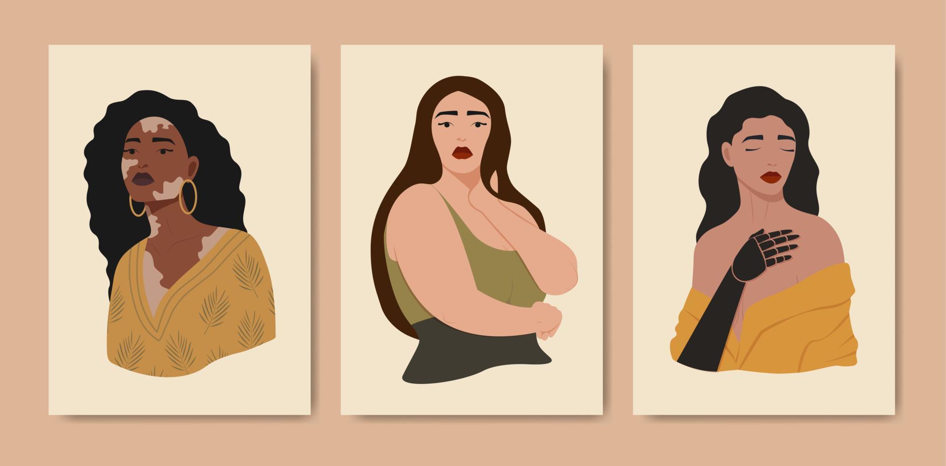 Set of beautiful diversity ladies on beigebackground. Poses for body positive girl. Women with vitiligo, overweight, prosthetic hand vector