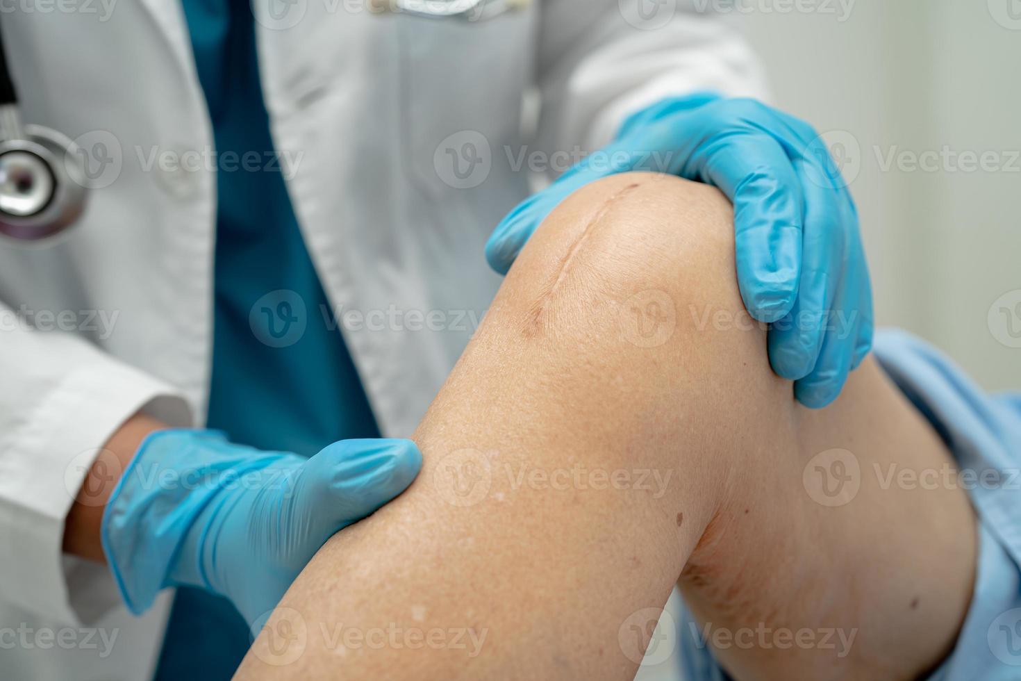 Doctor check Asian senior or elderly old lady woman patient scars surgical total knee joint replacement Suture wound surgery arthroplasty in hospital ward, healthy strong medical concept. photo