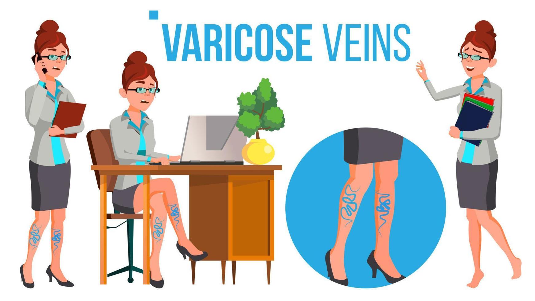 piernas femeninas en zapatos de tacón alto con vector de venas varicosas. ilustración de dibujos animados aislados