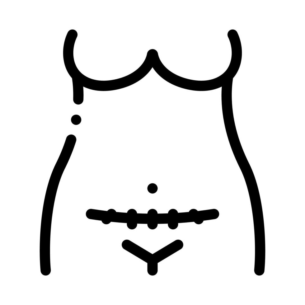 ilustración de vector de icono negro de cesárea