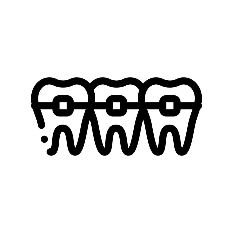 Dentist Stomatology Teeth Braces Vector Sign Icon