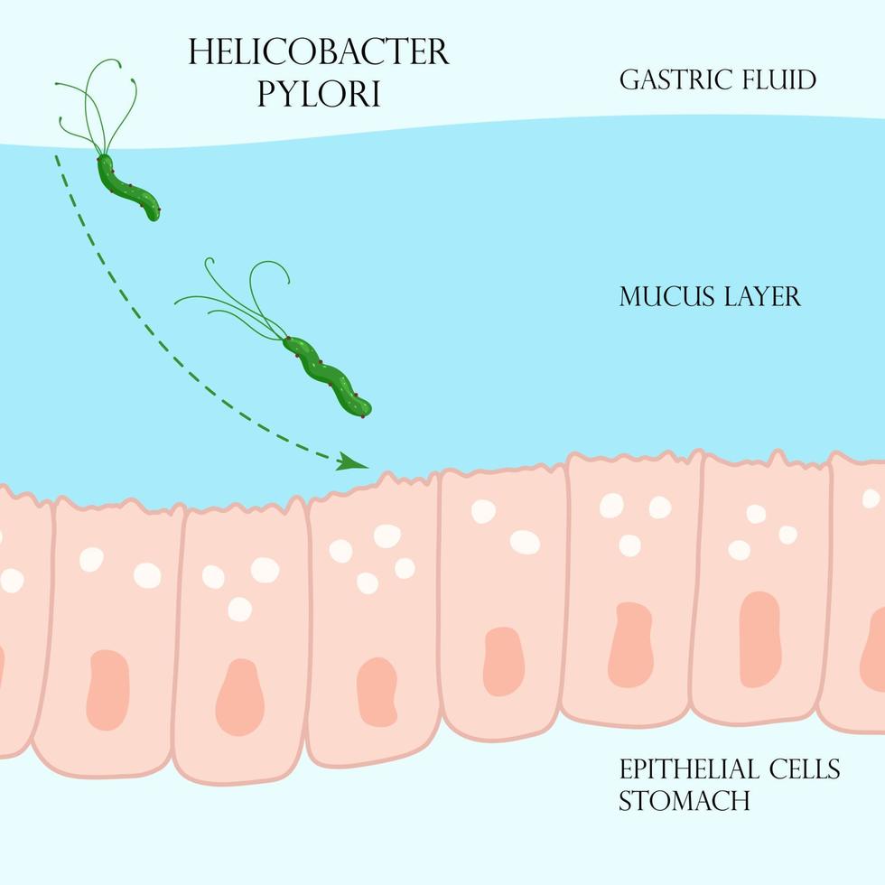 helicobacter pylori en la capa mucosa en la ilustración del estómago vector