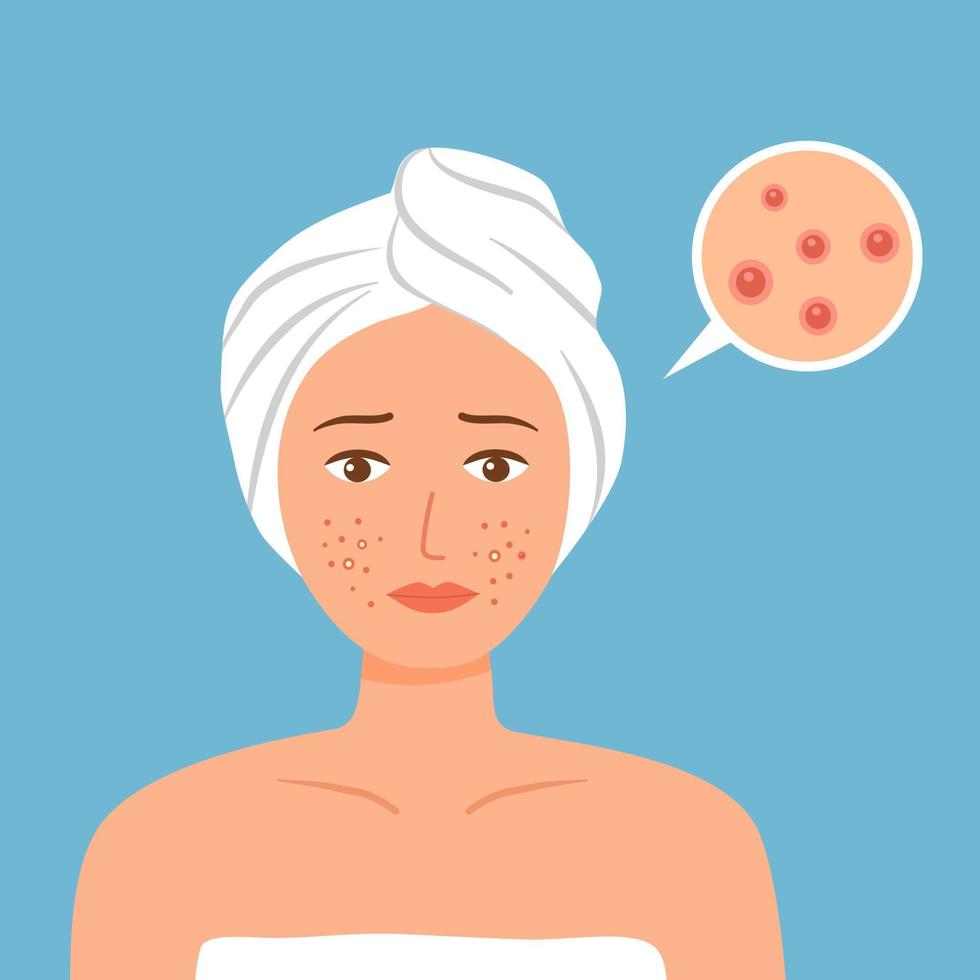 Sad woman worrying about her acne face in flat design. vector