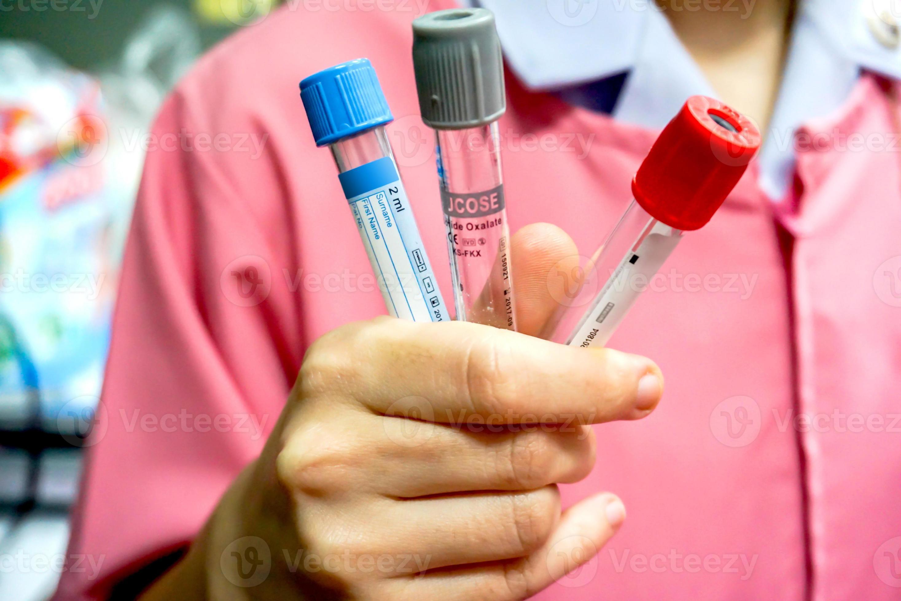 closeup and crop Medical Blood tube on nurse hand. 17521402 Stock Photo at Vecteezy