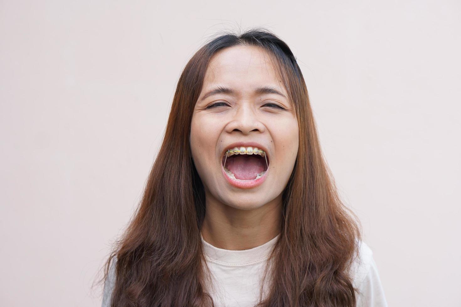 Asian women with disorganized braces photo