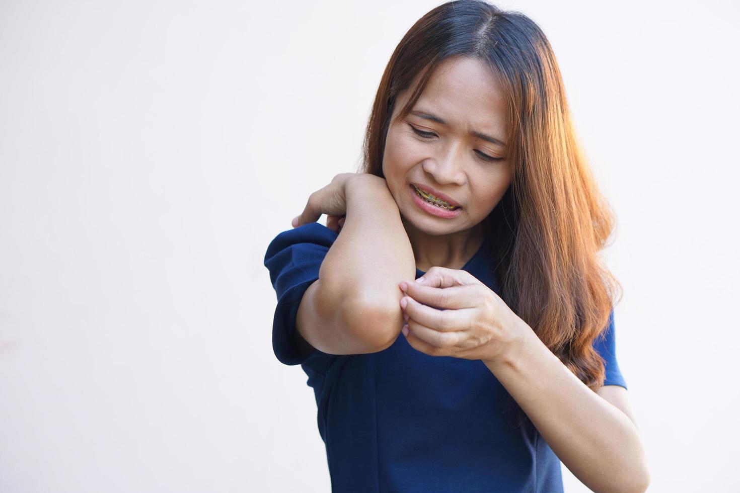 Asian woman having itchy skin photo