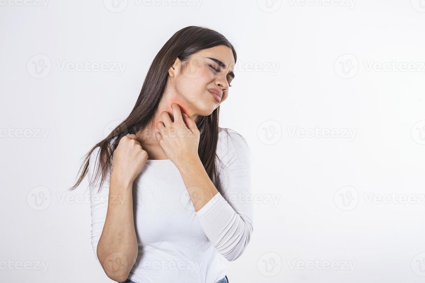 Young woman suffering from itching on her skin and scratching an itchy place. Allergic reaction to insect bites, dermatitis, food, drugs. Health care concept. Allergy rash photo