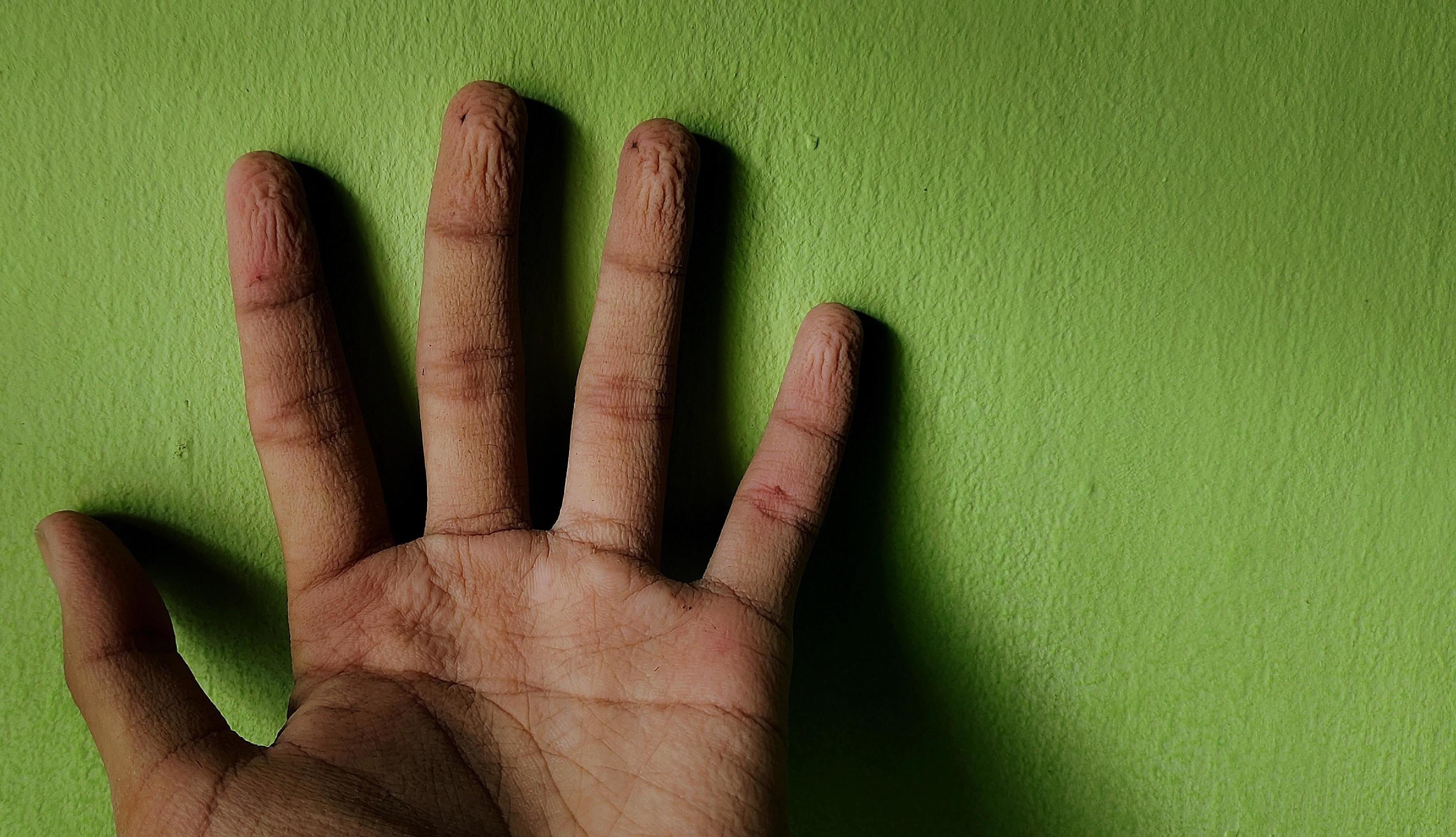 Fingers are wrinkled because they are exposed to water for too long