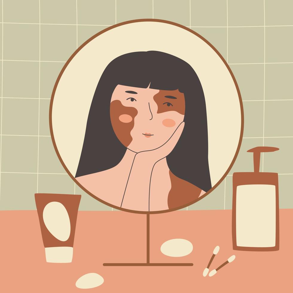 Happy woman with vitiligo looks in the mirror and touching face. Accepting oneself. Self-love. Skin disease. Smiling girls with skin problem. Stock vector illustration.