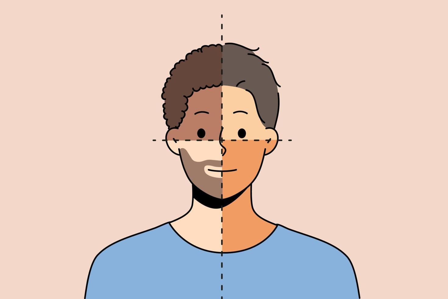 Young man with parts of different skin color show diversity and unity. Male portrait demonstrate community multinationalism and equality. Vector illustration.