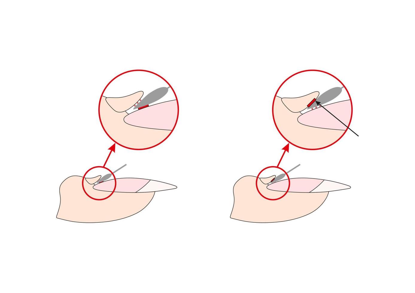 Nails cuticle instruction guide. Cutter manicure instrument. Tutorial. vector