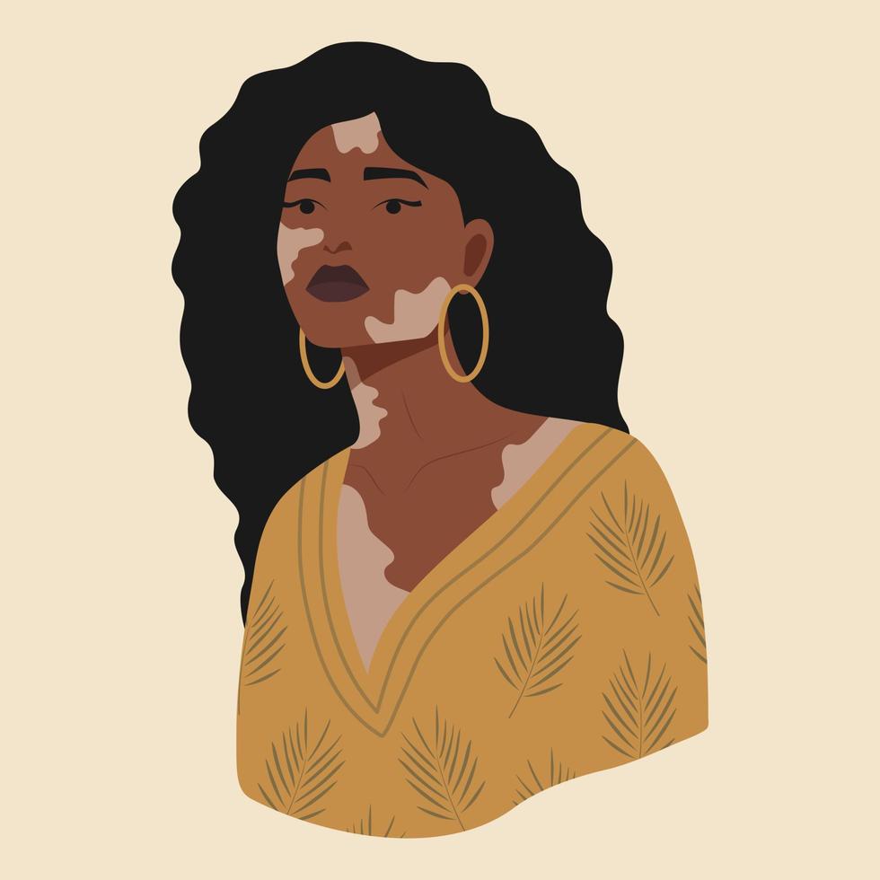 Woman with vitiligo on beige background. Poses for body positive girl. Simple cartoon style illustration for web graphic design and animation vector