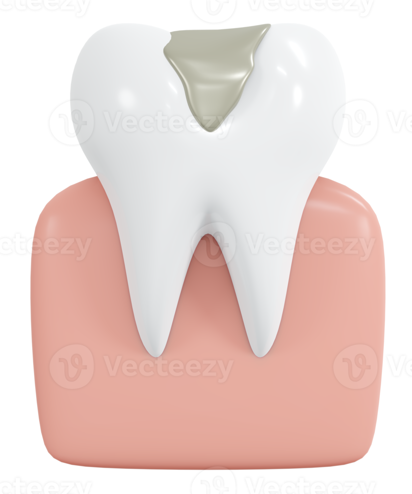 Diente de renderizado 3d con cavidad y estilo de dibujos animados de iconos llenos de titanio. Ilustración de procesamiento 3d. png