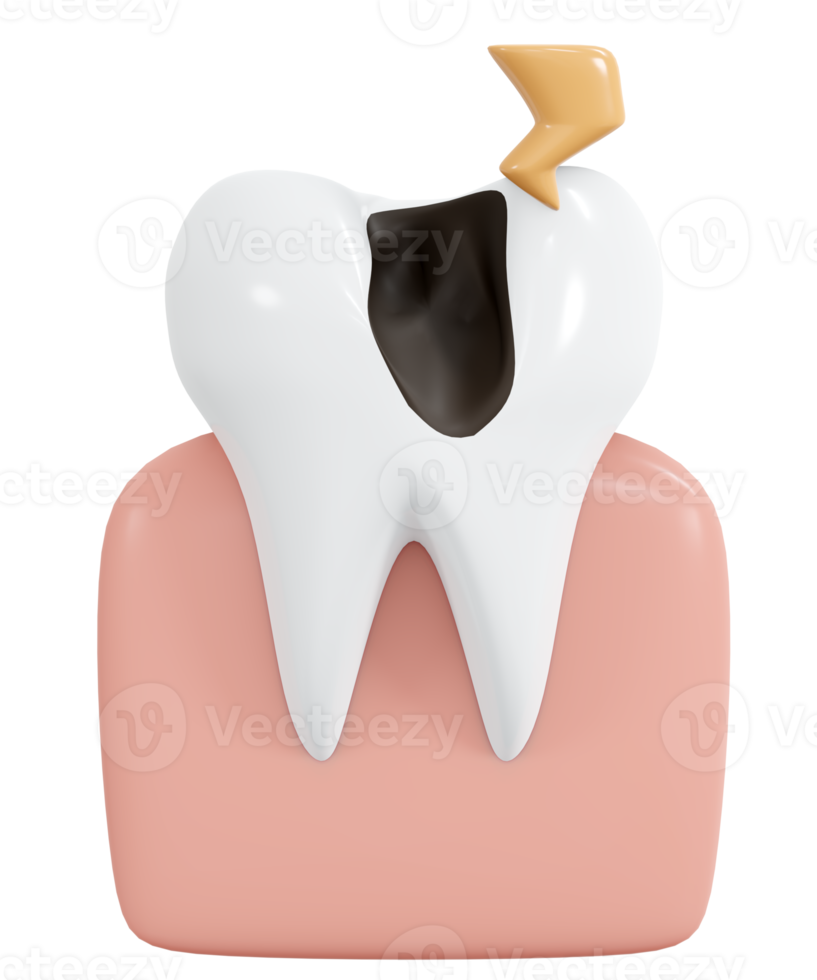 3D-Rendering Zahn mit Hohlraum und Schmerzsymbol Cartoon-Stil. 3D-Darstellung. png