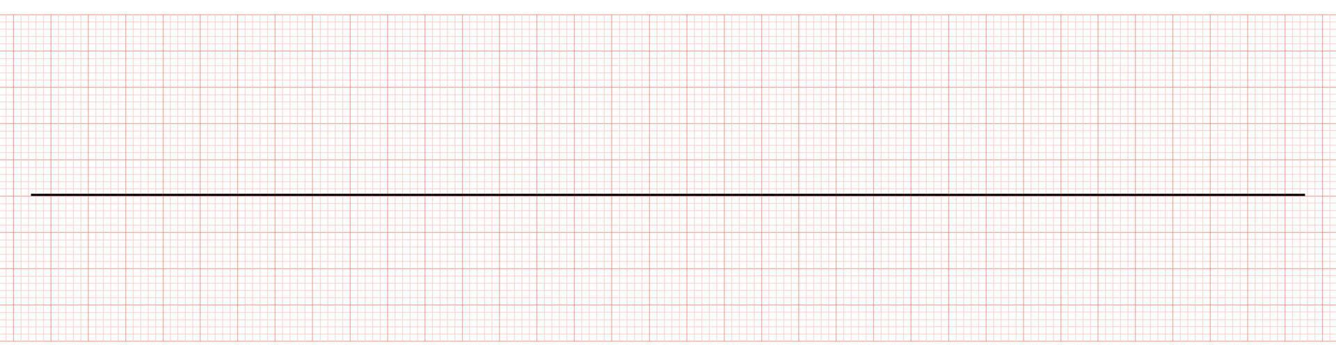 electrocardiograma que muestra una línea plana o asistolia vector