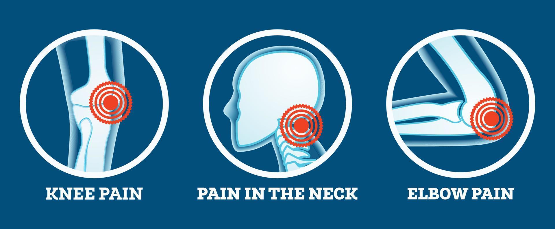 Body Pain. Icons Set. Pain in Knee, Neck and Elbow. Woman's and Man's Body Parts. vector