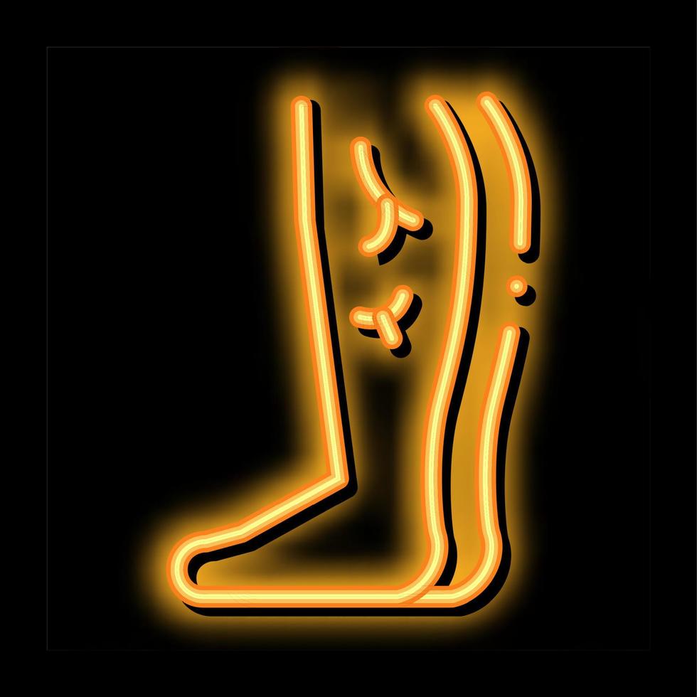 pierna con venas varicosas ilustración de icono de brillo de neón vector