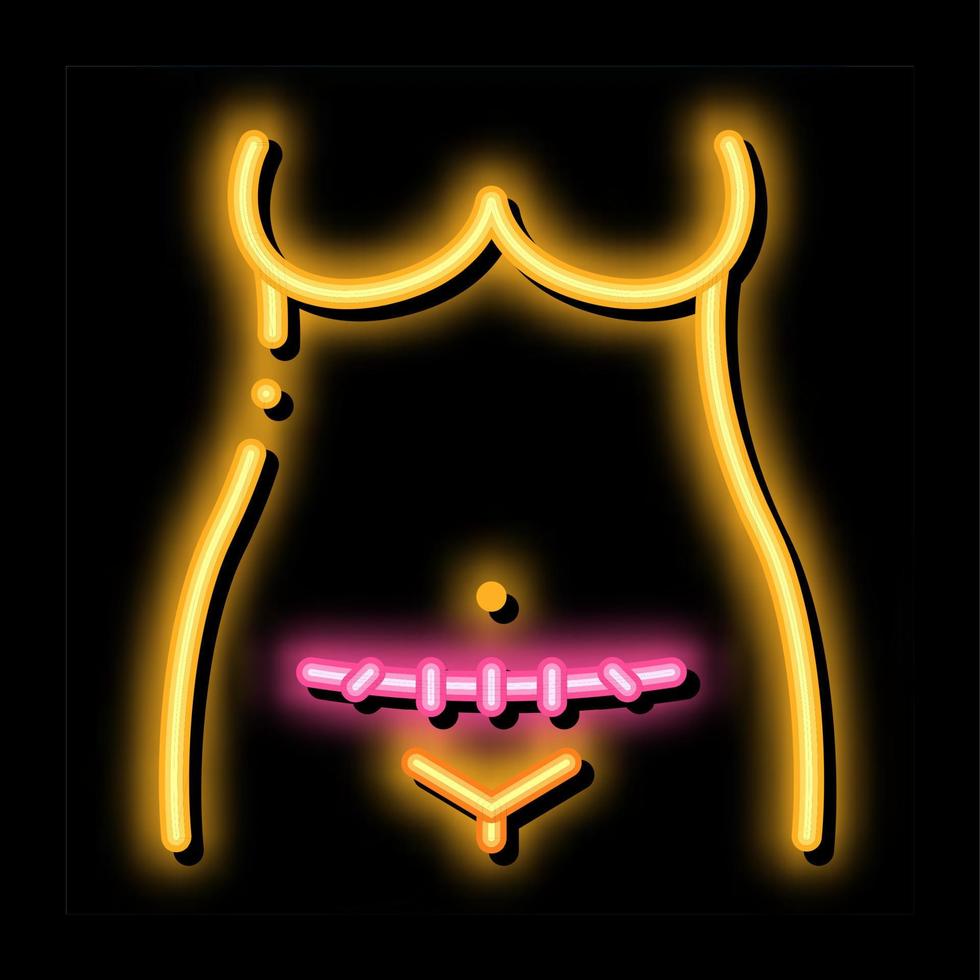 cesarean section neon glow icon illustration vector