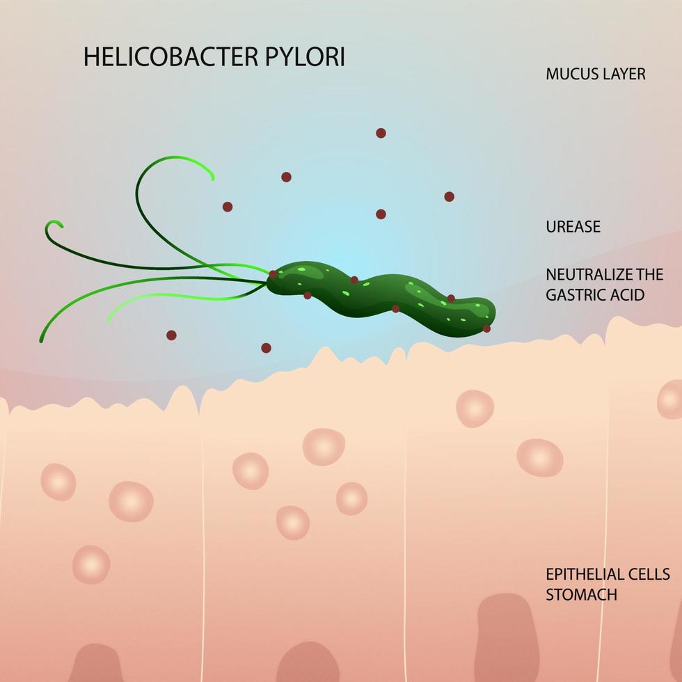 helicobacter pylori en células epiteliales en la ilustración del estómago humano vector