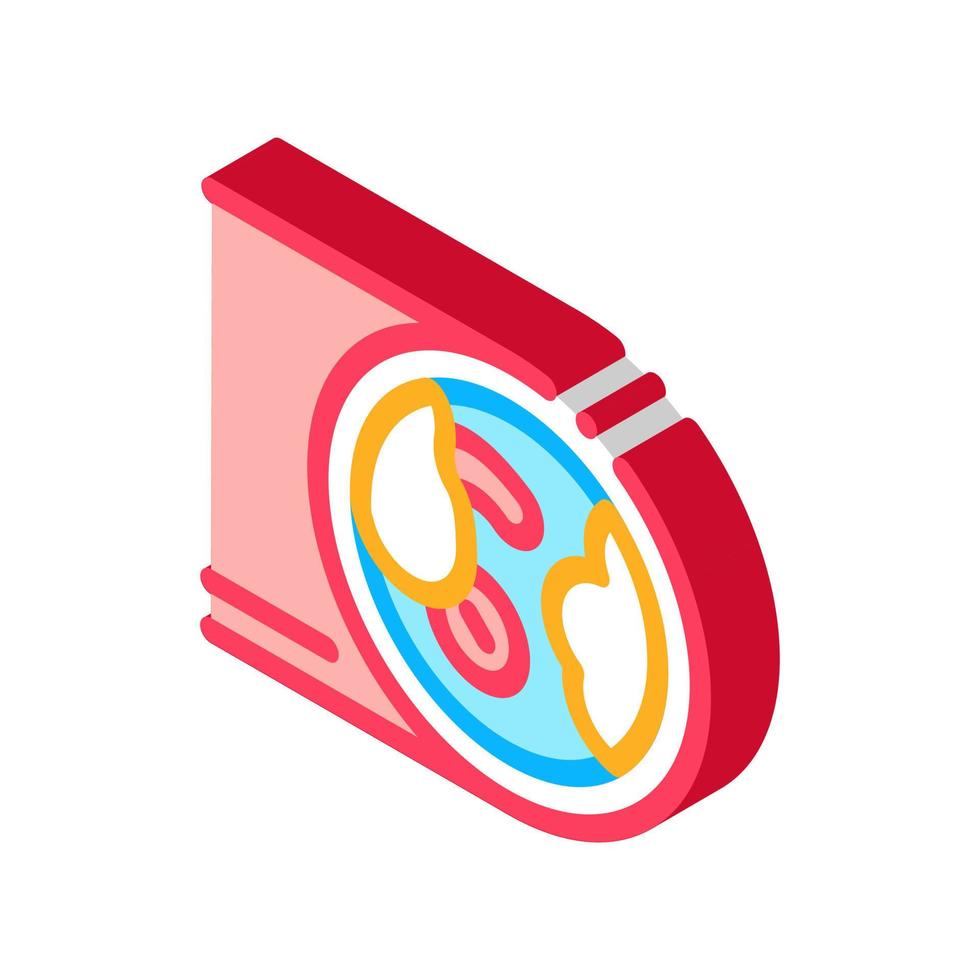 artery with atherosclerosis isometric icon vector illustration